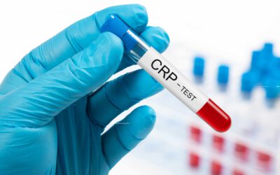 CRP-S Latex Immuno Turbidimetric Assay